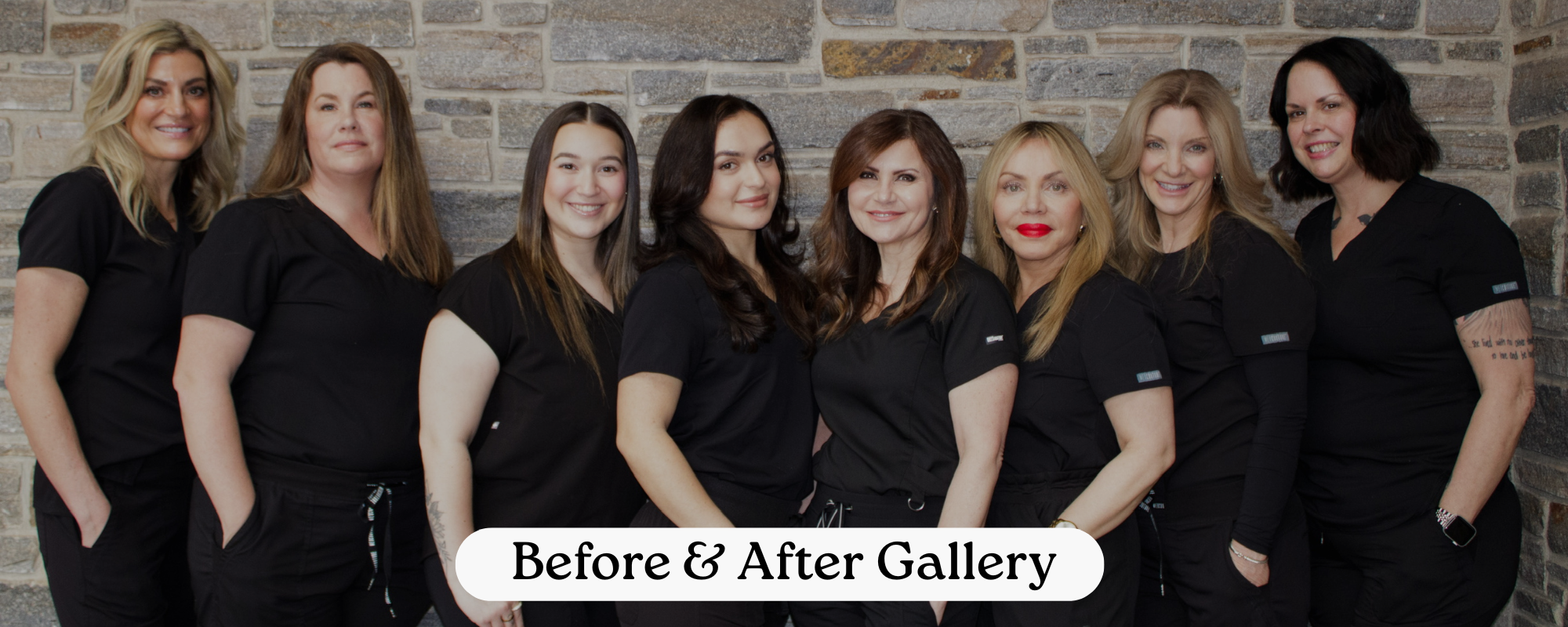 before and after aria medical aesthetics