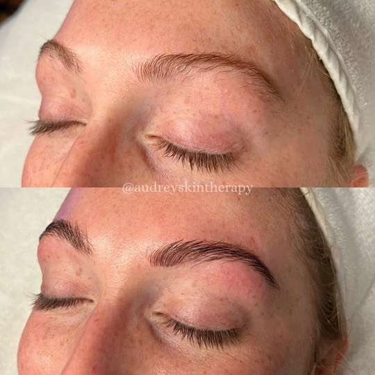 Aria Medical brow lamination treatment results
